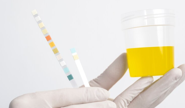 Fake Pee Duration: How Long Does It Stay Effective for Drug Tests?