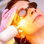 Pro Yellow Laser: Enhance and Balance Your Skin Tone Effectively