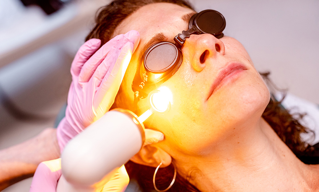 Pro Yellow Laser: Enhance and Balance Your Skin Tone Effectively